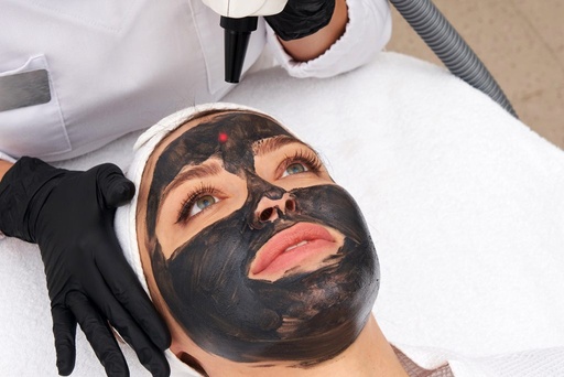 Carbon Peel visage