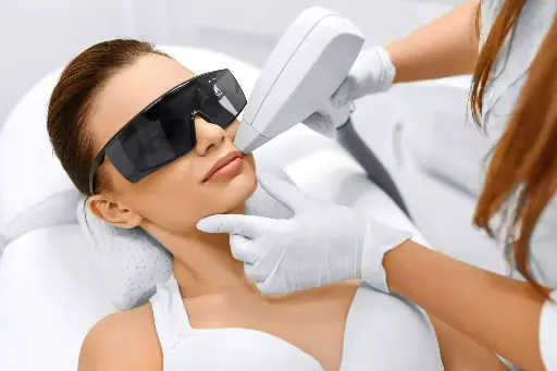 Epilation Laser : Zone Lèvre